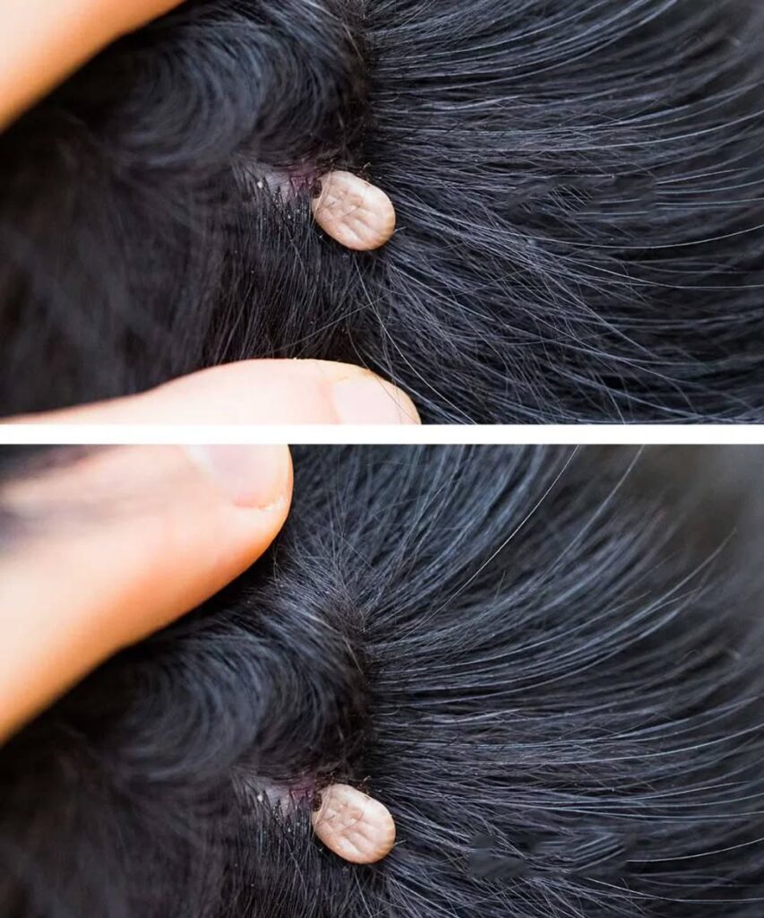 HT1. Just discovered this in my son’s hair. What is it? Not sure if we should go to doc