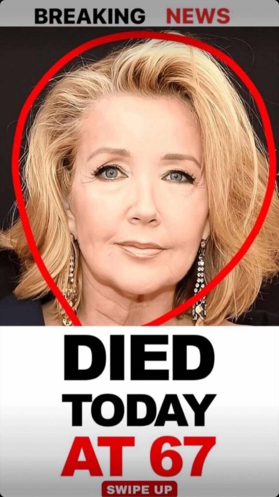 Famous Actress Opens Uo About Her Plastic Surgery