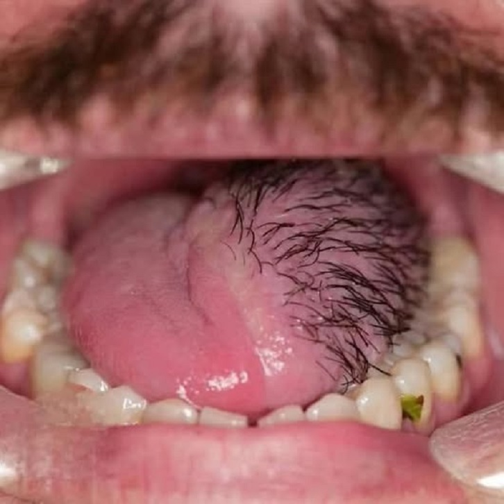 These are the consequences of eating …See more