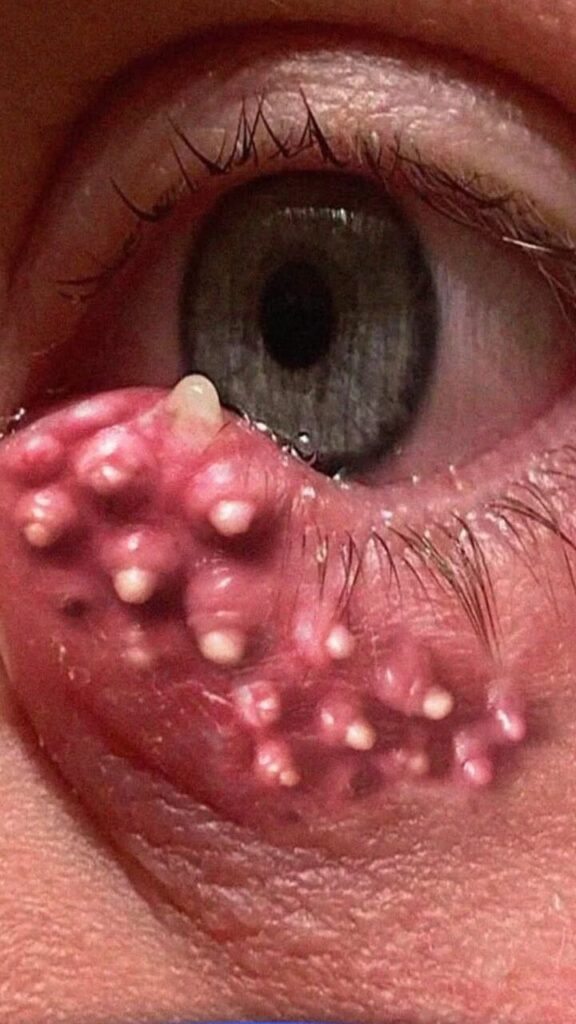 ⚠️ Important Rules for Eye Procedures Many People Ignore