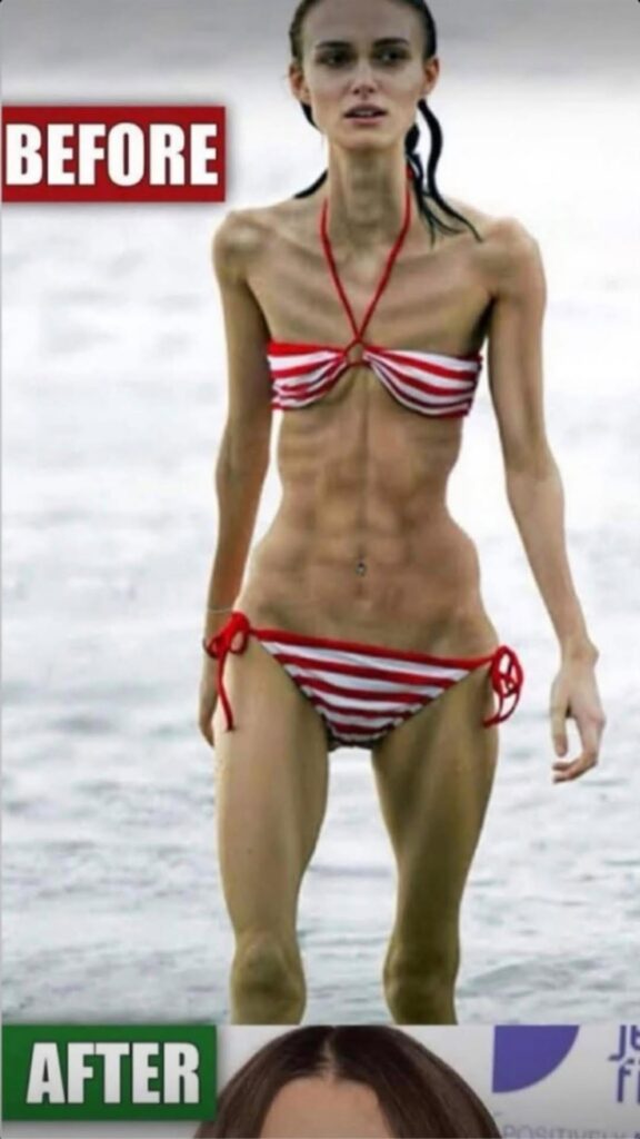This Viral Beach Photo Shocked Millions — Doctors Say It Could Be Dangerous