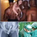 A NIGHT OF PARTYING ENDED IN THE HOSPITAL: VIRAL IMAGE TRIGGERS WARNINGS ABOUT THE RISKS OF INSERTING OBJECTS INTO THE BODY